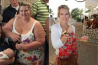 Gastric Bypass Results