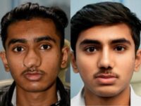 18-24 year old man treated with Rhinoplasty