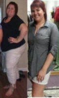 Gastric Sleeve Results